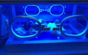 为什么要用光疗纸尿裤黄疸照蓝光有危害吗？如何分辨母乳性黄疸？_https://www.jmylbn.com_新闻资讯_第1张