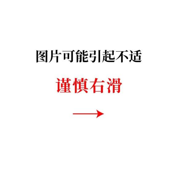 医生为什么叫买营养袋包装袋上有这类字的食物，肾友少碰_https://www.jmylbn.com_新闻资讯_第2张