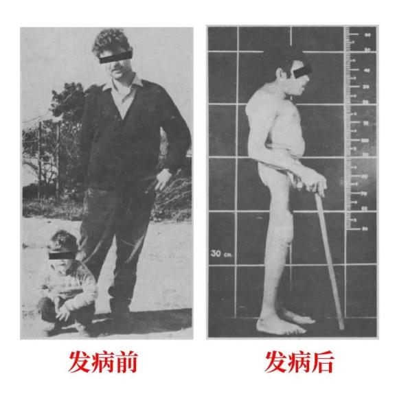 医生为什么叫买营养袋包装袋上有这类字的食物，肾友少碰_https://www.jmylbn.com_新闻资讯_第3张