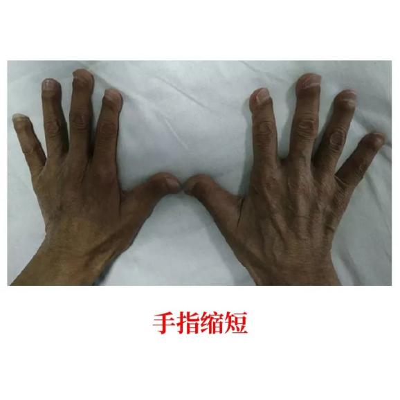 医生为什么叫买营养袋包装袋上有这类字的食物，肾友少碰_https://www.jmylbn.com_新闻资讯_第5张