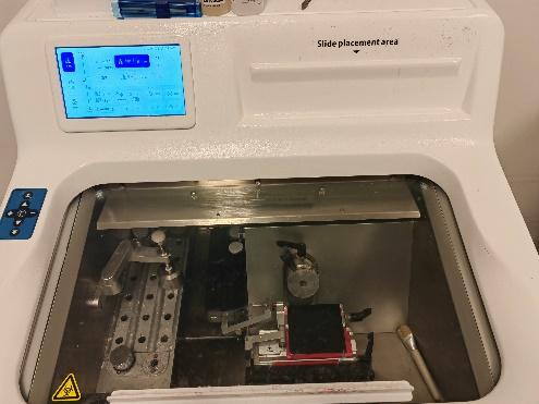 下使组织快速冷却到一定硬度,用于手术中急会诊的一种明确诊断的方法