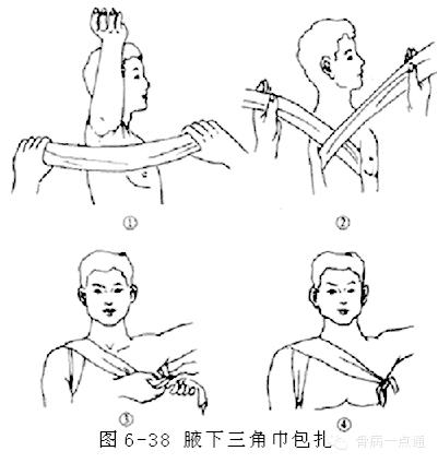 裹胸布正确绑法图片