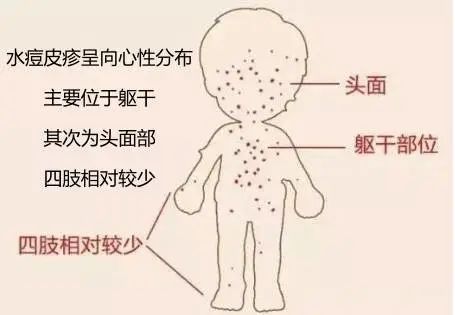 严重可致脑炎,这病号称"见面传"!_澎湃号·政务_澎湃新闻-the paper