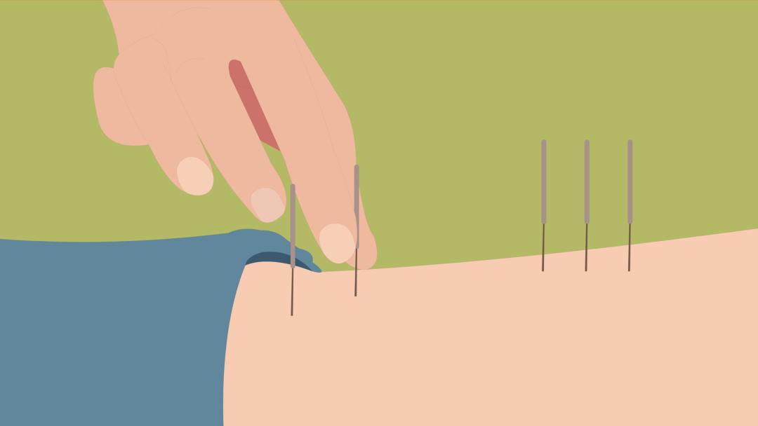 除了艾灸，还可以试试吹！风！机！丨健康总动员_澎湃号·政务_澎湃新闻-The Paper