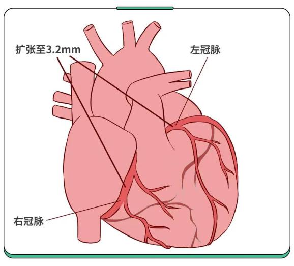 川崎病被誤診,我差點失去2歲兒子_澎湃號·湃客_澎湃新聞-the paper