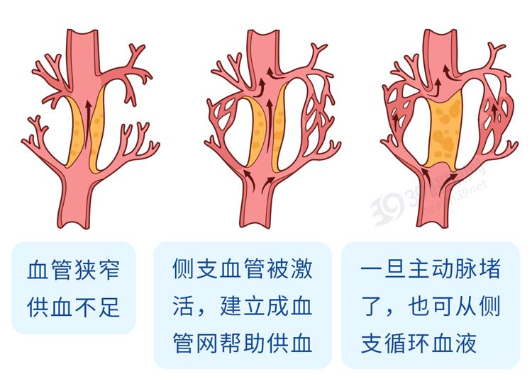 传入侧支性抑制示意图图片