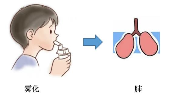 藥物是直接作用於呼吸道,直達病灶.霧化霧化沒有注射,吃藥效果好?