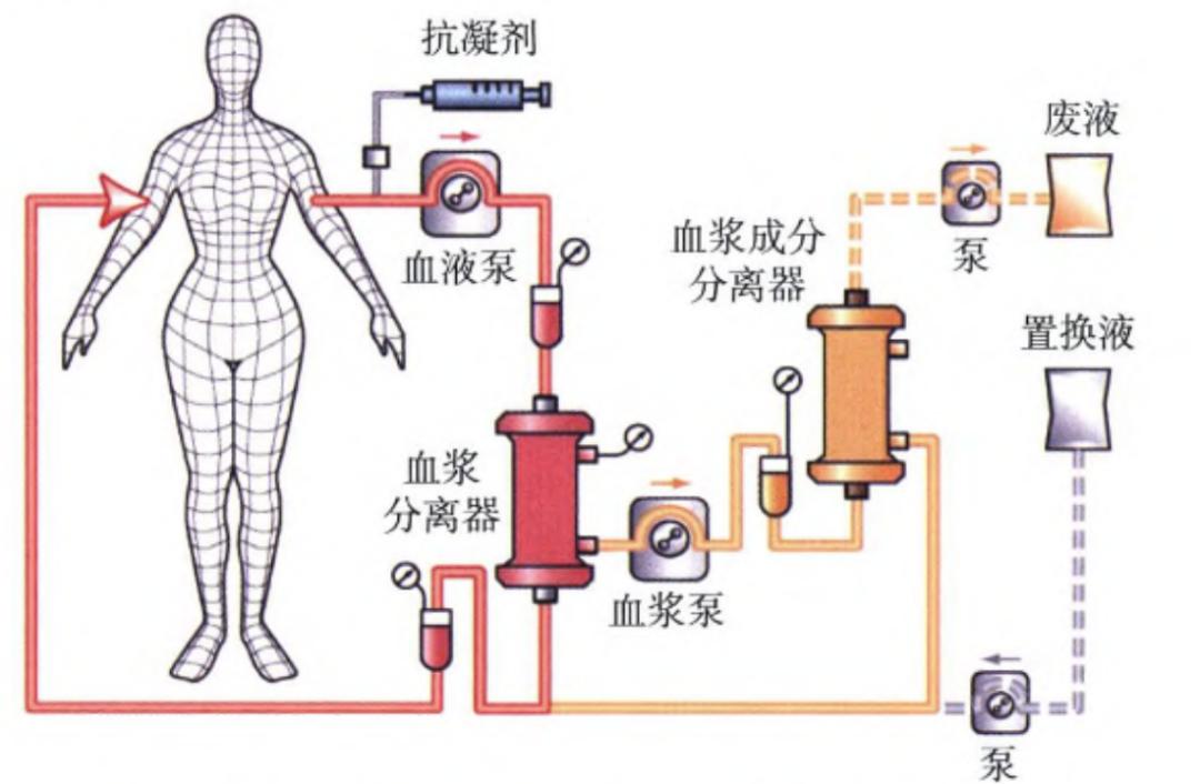 血液净化示意图图片