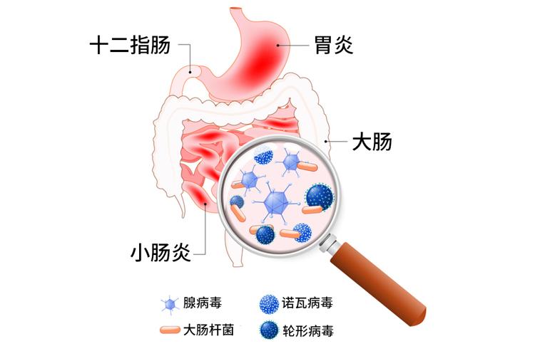 多喝水後出現這4個異常,儘早就醫_澎湃號·湃客_澎湃新聞-the paper