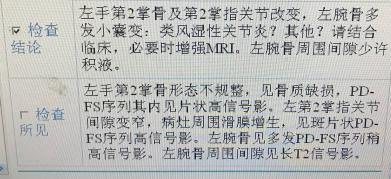 幾天後結果全部出來了,血沉,c反應蛋白還是很高,而且提示類風溼關節炎