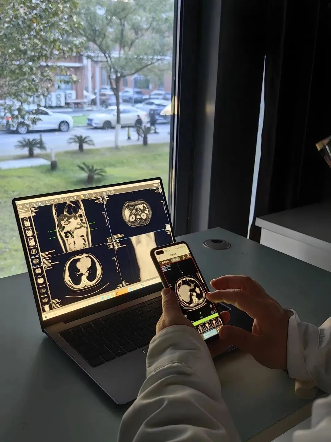 DR胶片为什么分尺寸告别“塑料袋+胶片”，中山青浦分院“电子胶片”上线，一起看看它有多强大？_https://www.jmylbn.com_新闻资讯_第1张