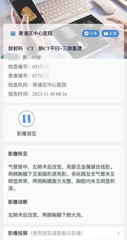 DR胶片为什么分尺寸告别“塑料袋+胶片”，中山青浦分院“电子胶片”上线，一起看看它有多强大？_https://www.jmylbn.com_新闻资讯_第2张