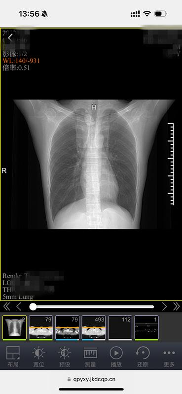 DR胶片为什么分尺寸告别“塑料袋+胶片”，中山青浦分院“电子胶片”上线，一起看看它有多强大？_https://www.jmylbn.com_新闻资讯_第3张
