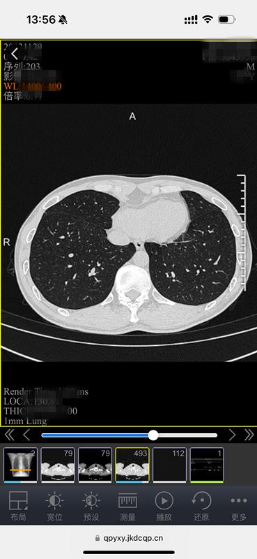 DR胶片为什么分尺寸告别“塑料袋+胶片”，中山青浦分院“电子胶片”上线，一起看看它有多强大？_https://www.jmylbn.com_新闻资讯_第4张
