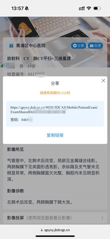 DR胶片为什么分尺寸告别“塑料袋+胶片”，中山青浦分院“电子胶片”上线，一起看看它有多强大？_https://www.jmylbn.com_新闻资讯_第7张