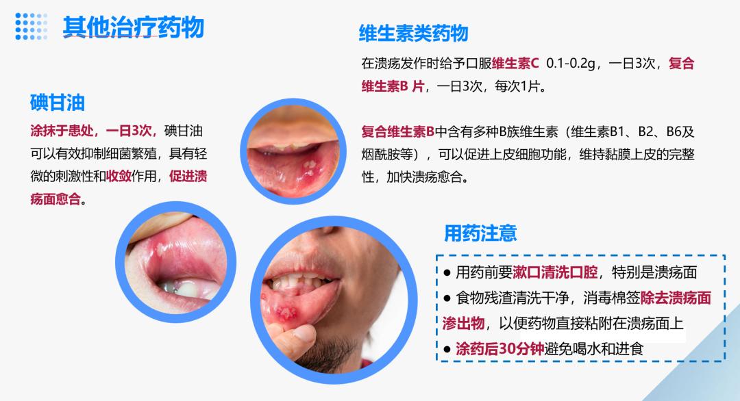 口腔溃疡反复发作怎么办？_澎湃号·湃客_澎湃新闻-The Paper
