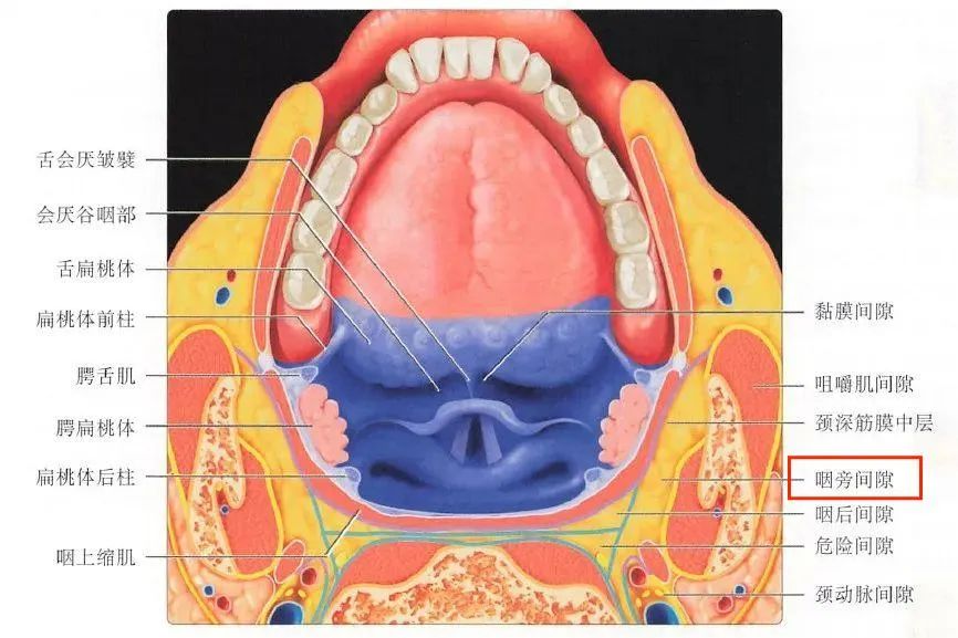 由于咽旁间隙位置特殊,上起颅底,下至舌骨,位置深,解剖关系复杂,手术