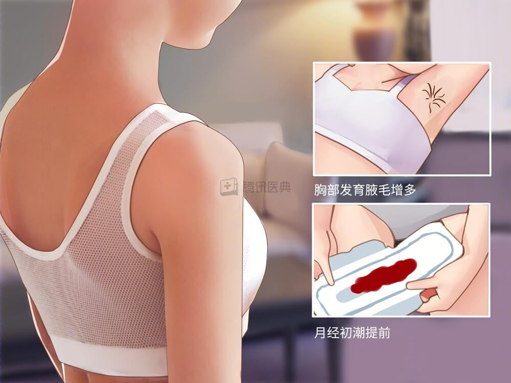 性早熟的真相,父母必看