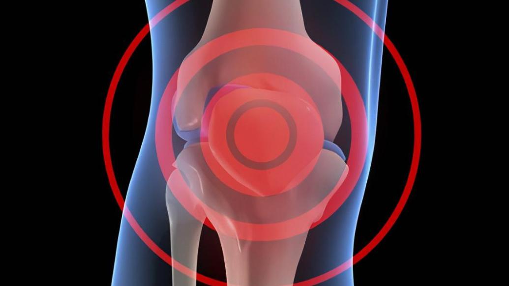 膝骨关节炎也有节律性？