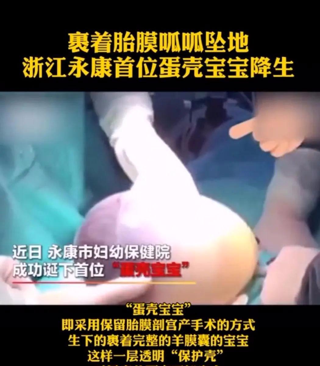 孕妇生出"包衣童",爸爸大叫"怪胎",医生:大富大贵之命_澎湃号·湃客