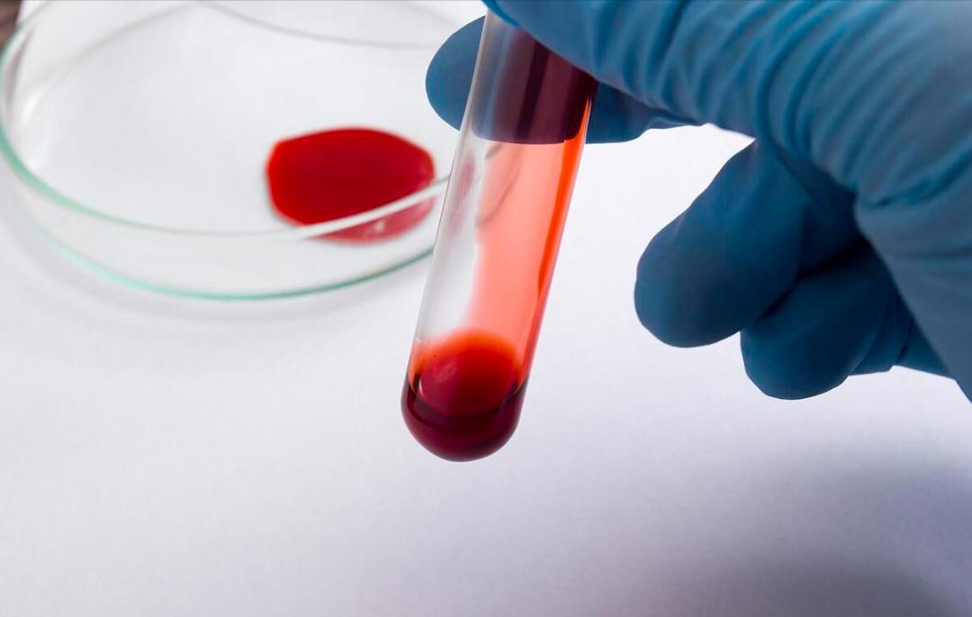血液粘稠的人,身体会有这些表现_澎湃号·湃客_澎湃新闻-the paper