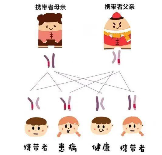 戈谢病的患病率是多少？如何识别戈谢病？