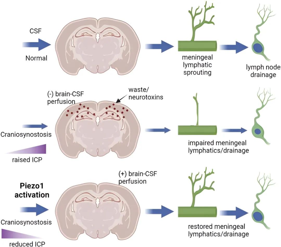 一种药物可以修复大脑的排污系统_澎湃号·湃客_澎湃新闻-the paper