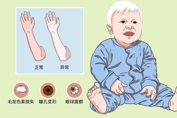 这是一种通过x染色体遗传的遗传性出血性疾病.