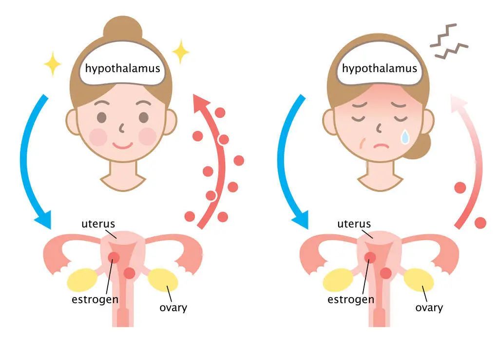 "谁痛谁知道"——子宫腺肌症要切子宫吗?