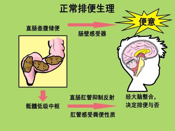 找不到"肠"的先天性巨结肠