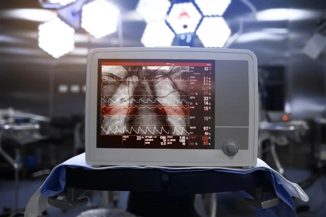 肠电图能查看什么体检不做这4项检查，相当于白做，得了癌症都不知道_https://www.jmylbn.com_新闻资讯_第8张