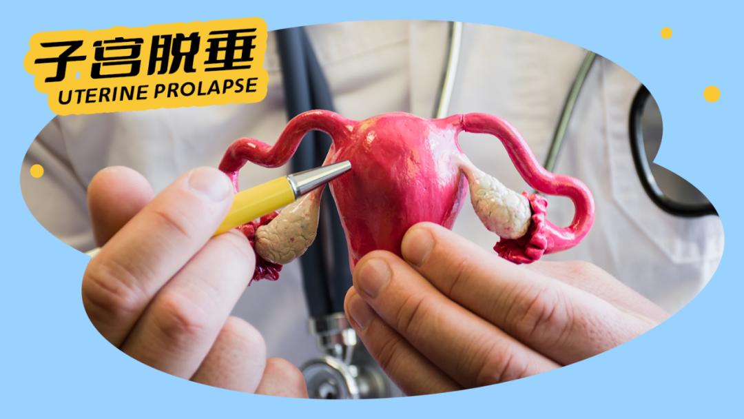 如果身体有这几种表现,一定要小心"脱垂"_澎湃号