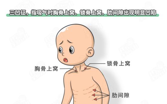 支气管炎的位置图片图片