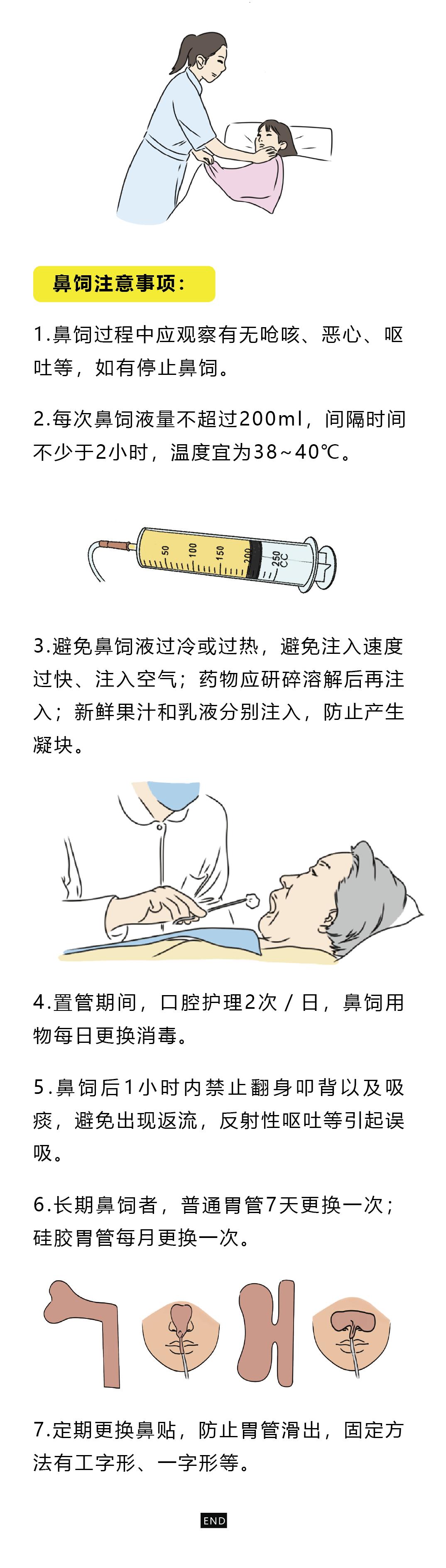 居家为患者鼻饲喂养时这样做