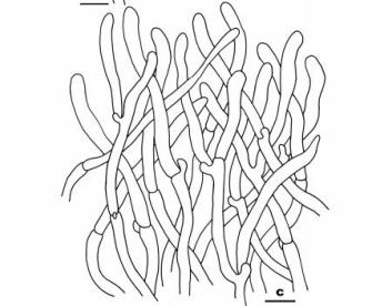 厌氧杆菌简笔画图片