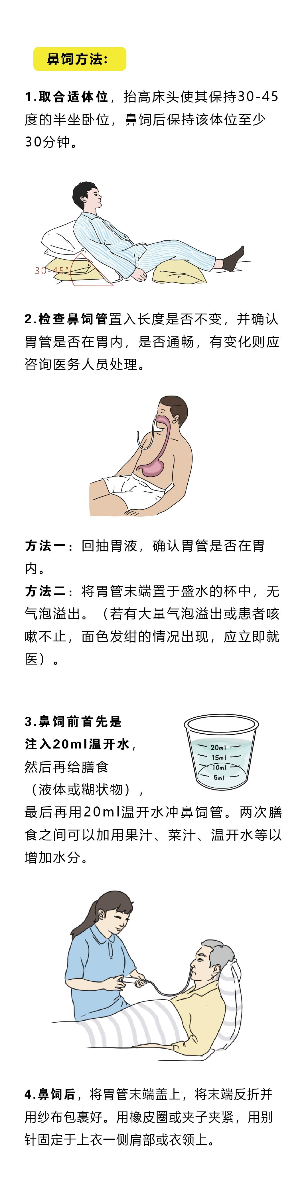 居家为患者鼻饲喂养时这样做|贤医健康说