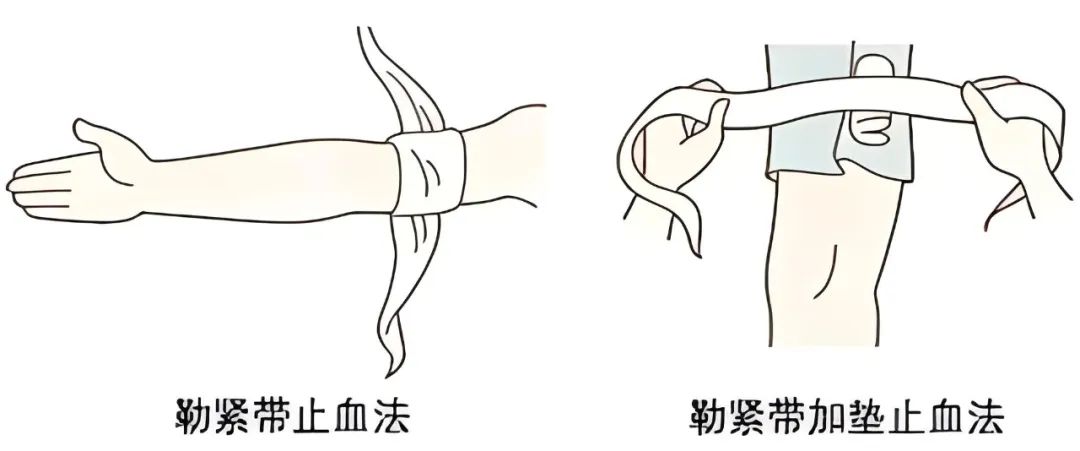 小伙手掌整个绞断,军医8小时成功"接活"!