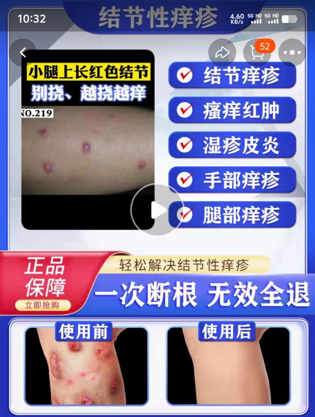 卫生监督告诉你 | 315消费提示——谨防网络上宣称疗