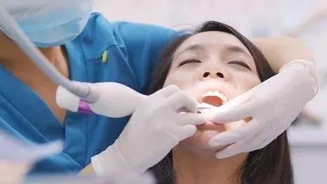 口腔医生：牙缝里的牙垢又臭又硬
