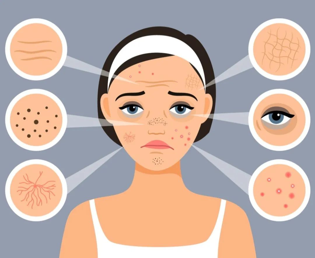 肝主"藏血",肝血不足,皮肤易粗糙,脱屑,增厚,因此,养血润肤,或在疏风