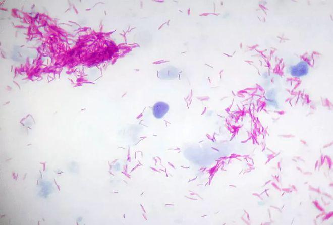 显微镜下结核杆菌图片图片