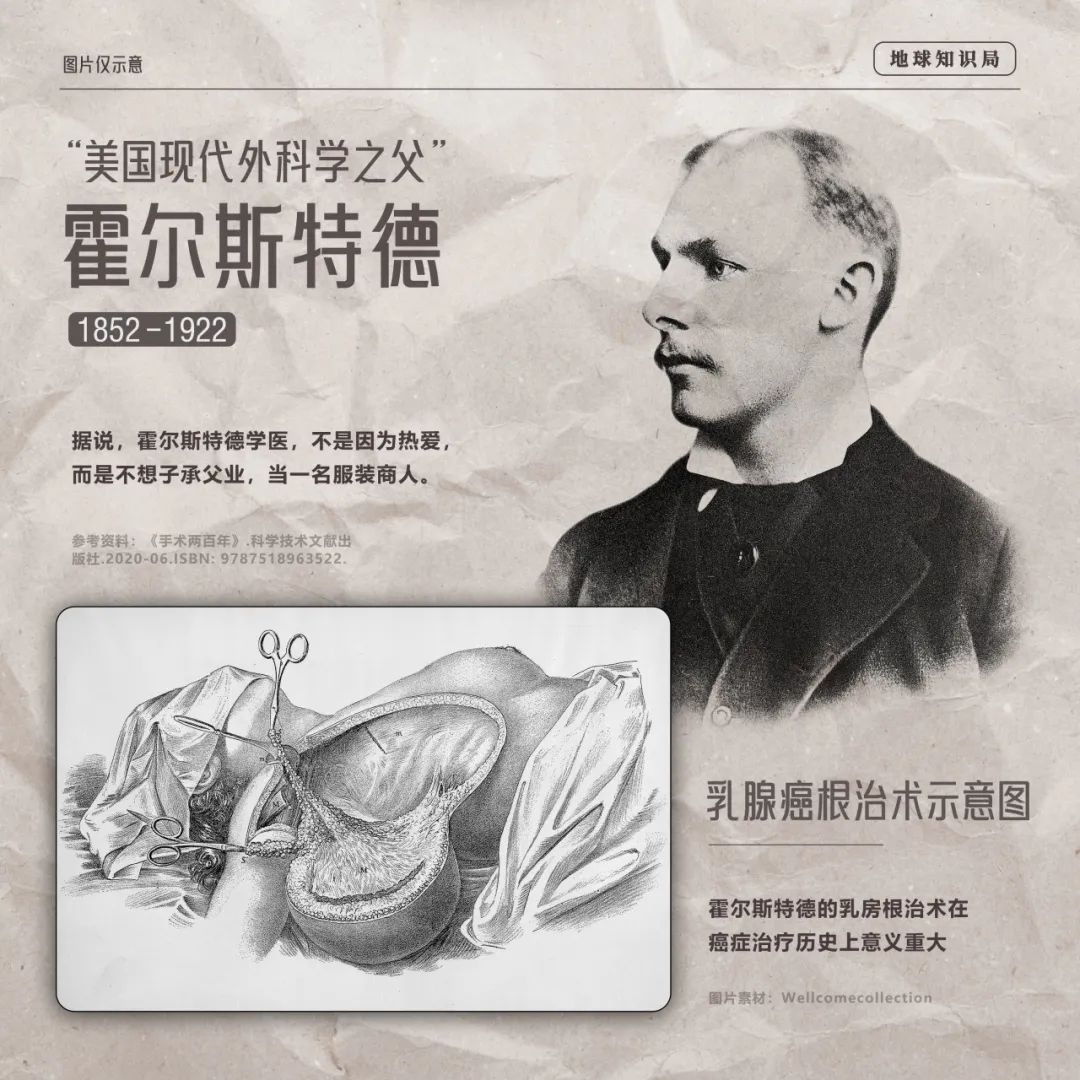 "乳房第一杀手",每年两百多万病例_澎湃号·湃客_澎湃新闻-the paper