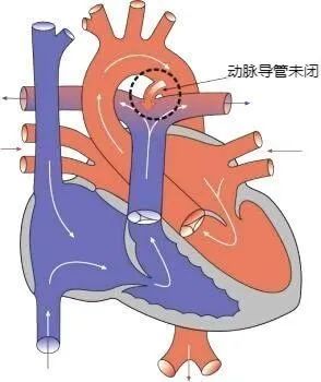 小叶间动脉图片图片