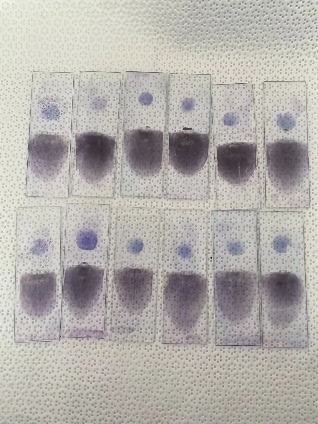 疟疾血片制作染色步骤图片