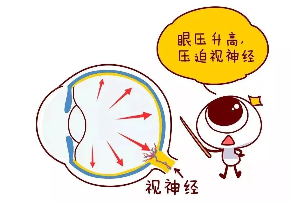 深夜关灯玩手机,小心青光眼"偷走"你的视力!