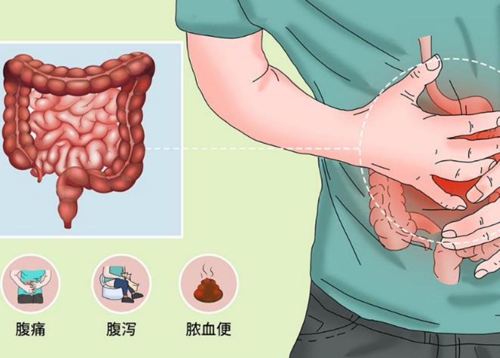 肠炎症状疼痛位置图图片