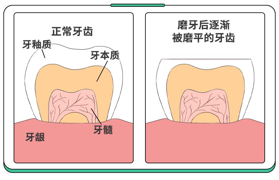 上颌第二磨牙位置图片