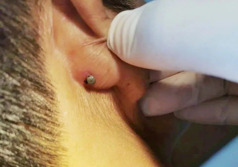 浦江天气大转折!还要小心"它们" →_澎湃号·政务_澎湃新闻-the paper