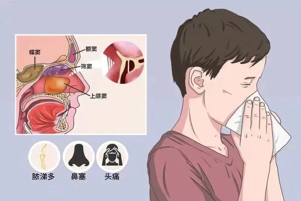 知己知“鼻”,畅快呼吸丨全国爱鼻日