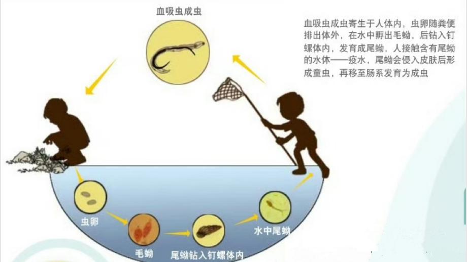 血吸虫病图片大全图片